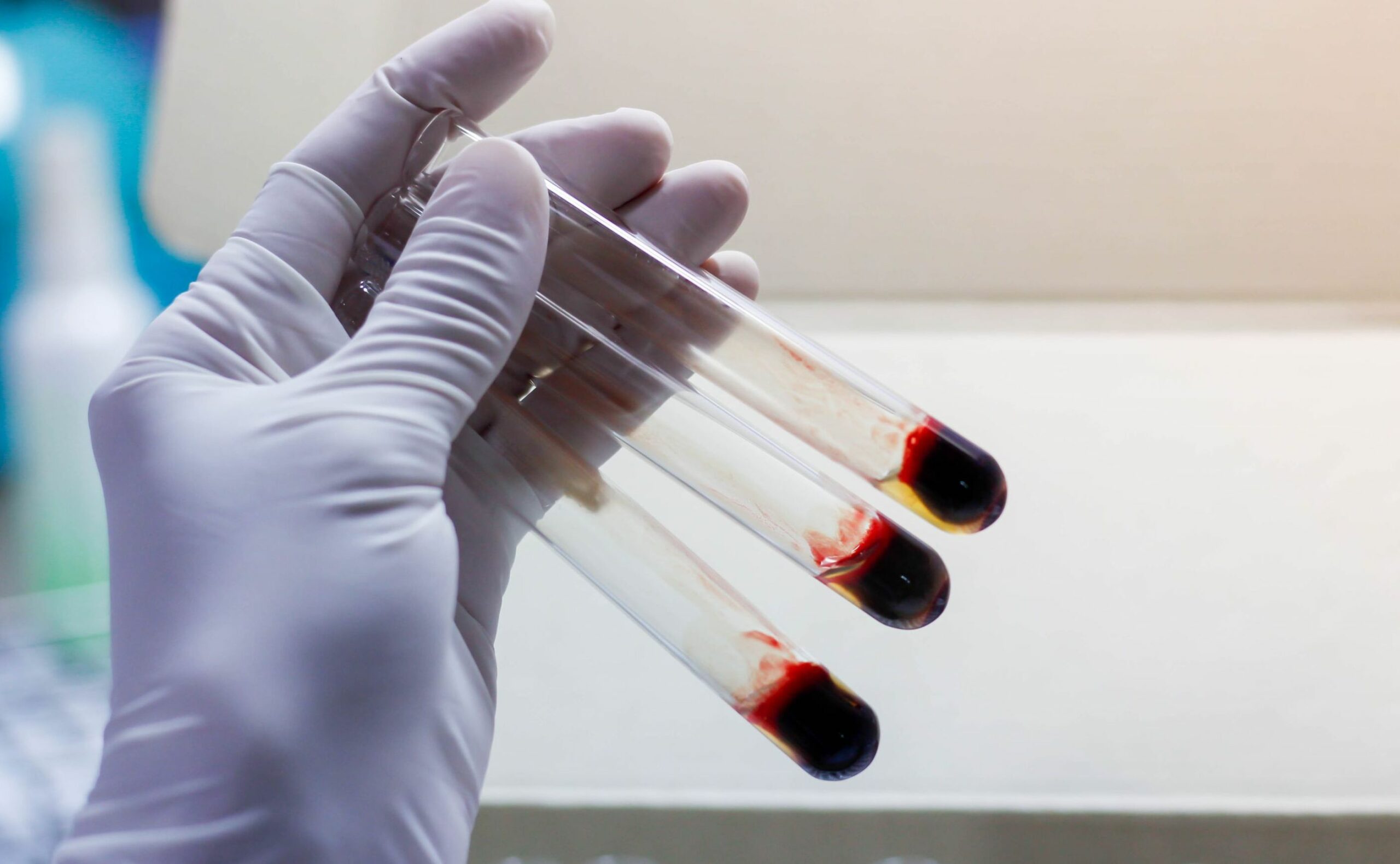 laboratorium krew badanie shutterstock scaled