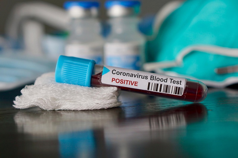 koronawirus test z krwi