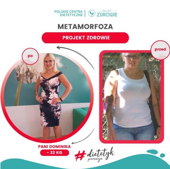Bezpłatne konsultacje z dietetykiem w Projekt Zdrowie Lublin Czechów w ramach akcji "To jesteś Ty? Pomożemy Ci!" 4 Metamorfoza Pani Dominika 1